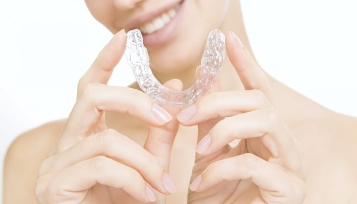 Invisalign - Orthodontie adulte Paris