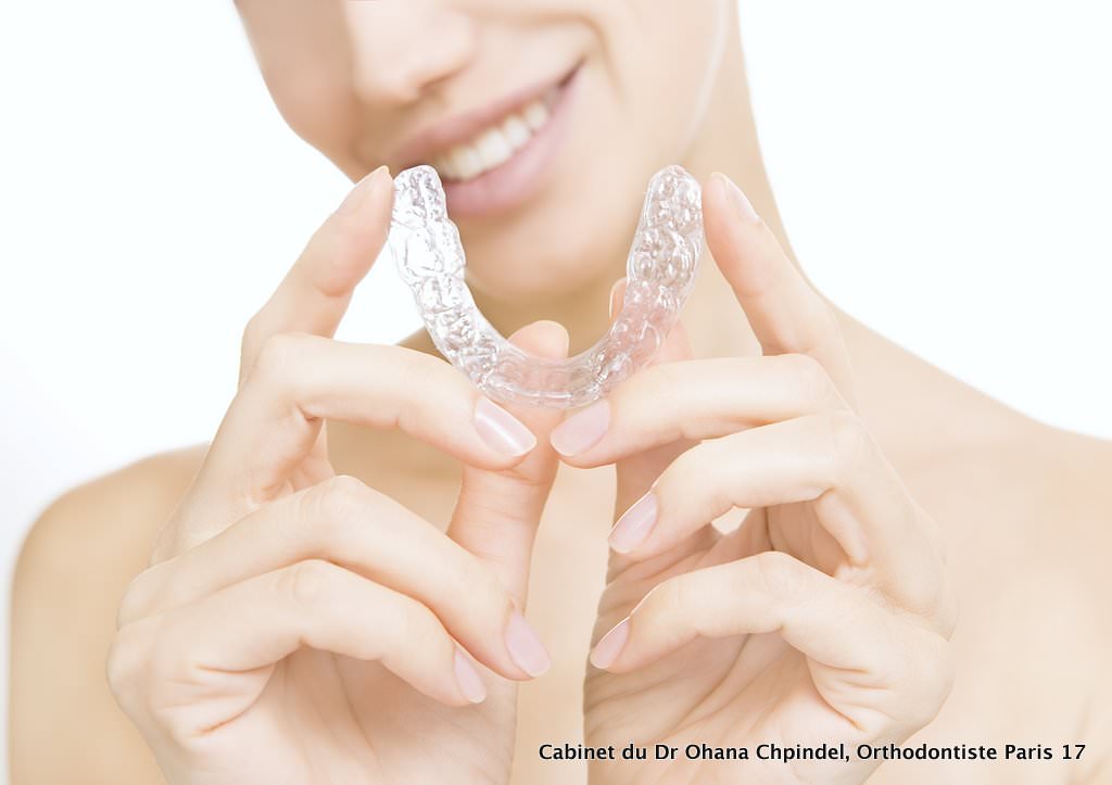 teeth Whitening - smiling girl with tooth tray