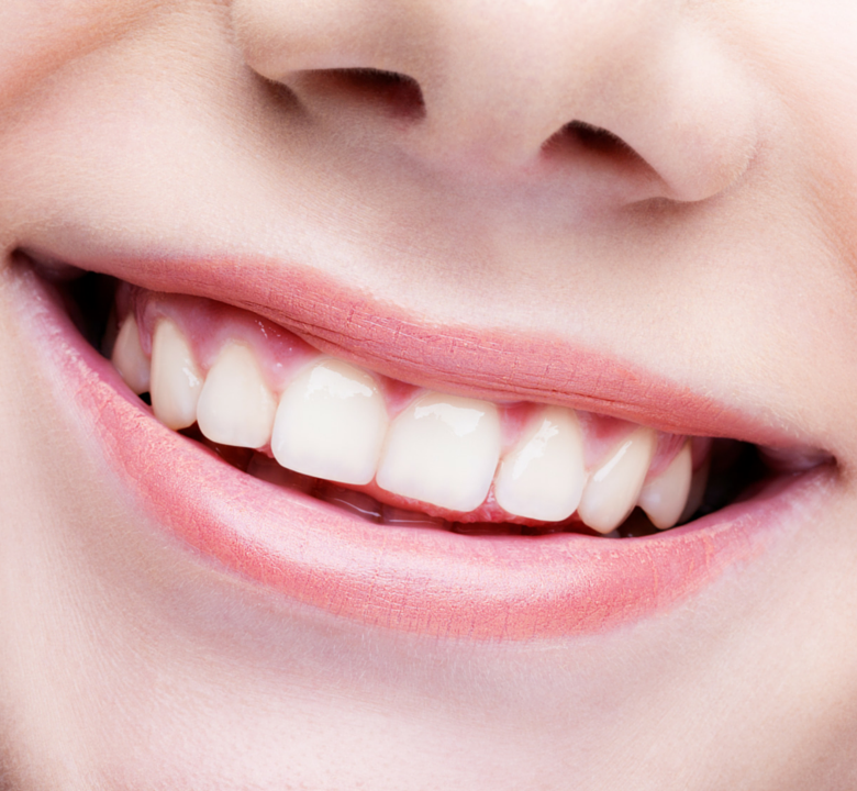 Sourires en orthodontie