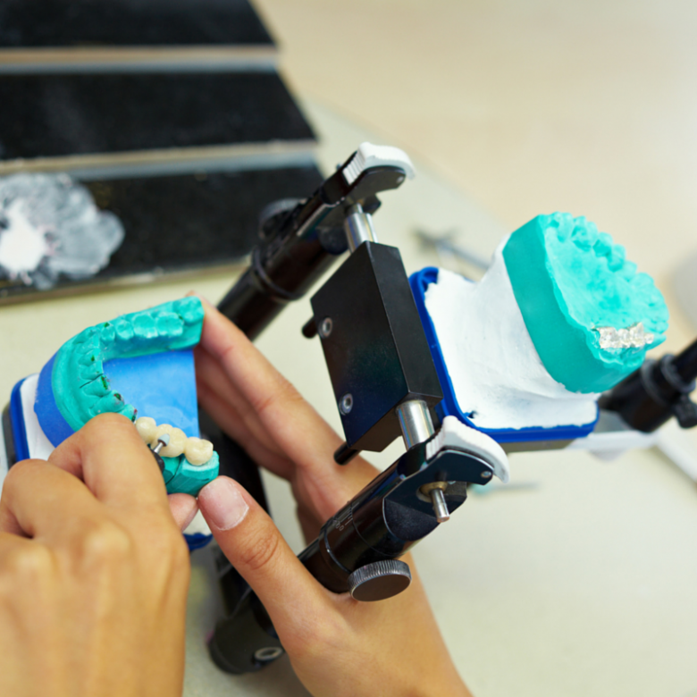 Traitement orthodontique et implant dentaire