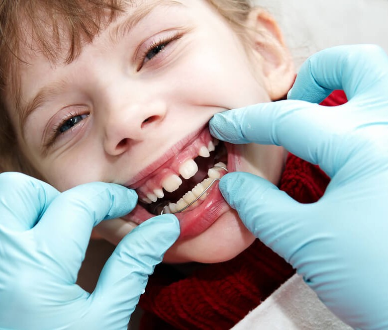 Traitement en orthodontie fonctionnelle a Paris