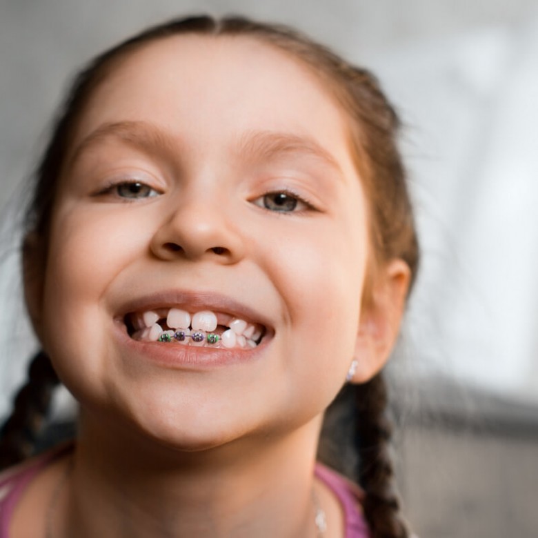 traitement d'interception à Paris par le Dr Ohana