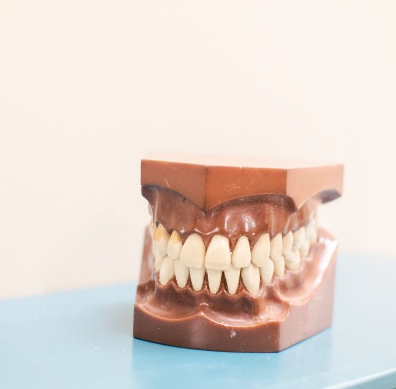 Le Docteur Ohana propose la pose d'élastiques orthodontiques