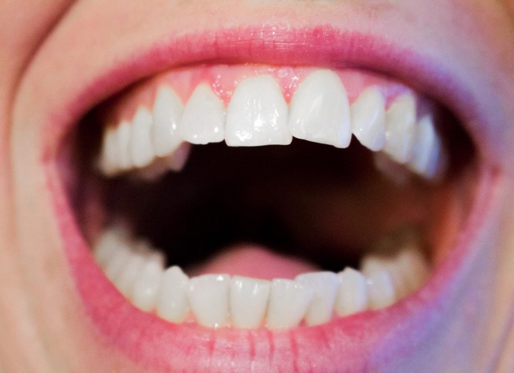 Traitement d'orthodontie invisible efficace et de qualité
