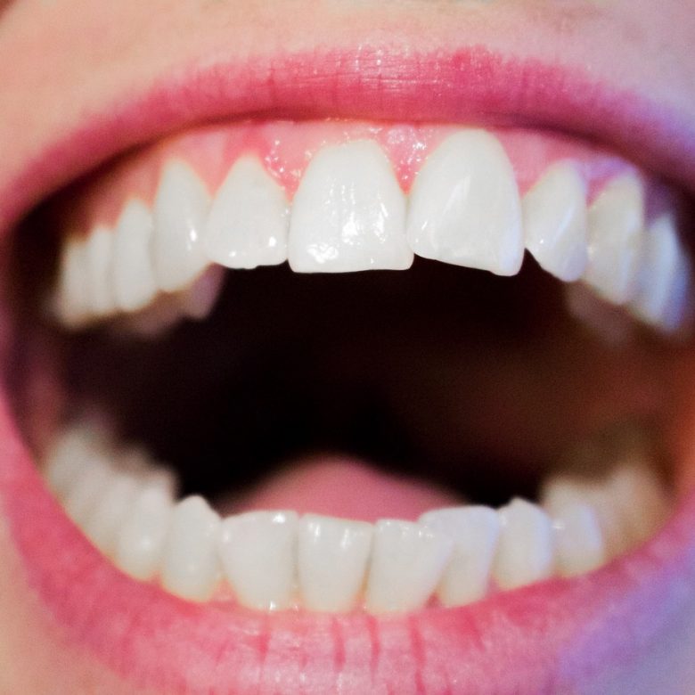 Traitement d'orthodontie invisible efficace et de qualité