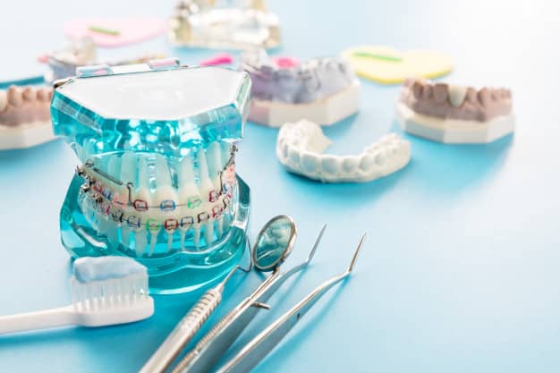 Le Dr Ohana Chpindel propose les forces extra orales paris