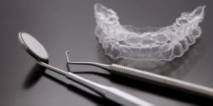 Les différents traitements orthodontiques Paris 17