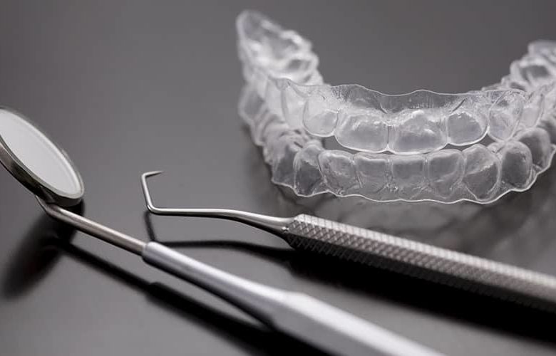 Les différents traitements orthodontiques Paris 17