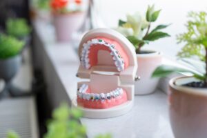coûts et prise en charge orthodontie