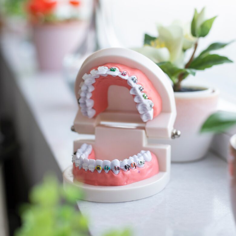 coûts et prise en charge orthodontie