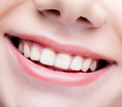 Sourires en orthodontie