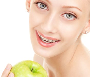 bagues et brackets orthodontique à Paris chez l'adolescent