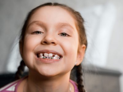 orthodontie enfant
