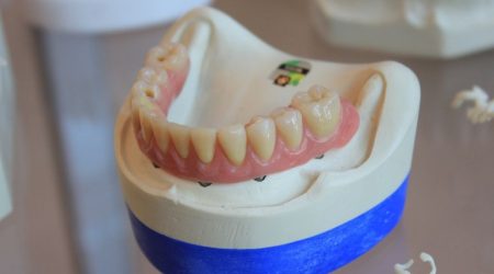 Opération de chirurgie orthognatique à Paris