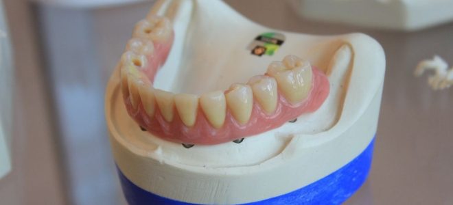 Opération de chirurgie orthognatique à Paris