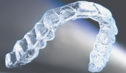 Contention pour la fin d'un traitement Invisalign par le Docteur Ohana Chpindel