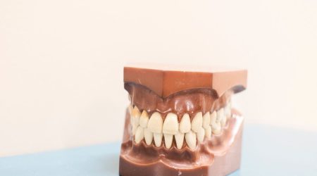 Le Docteur Ohana propose la pose d'élastiques orthodontiques