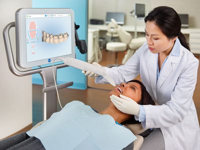 itero-align-technology-2x